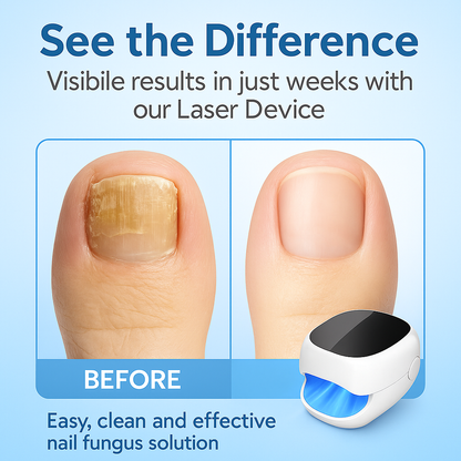 Nail Fungus Treatment LED Laser Device
